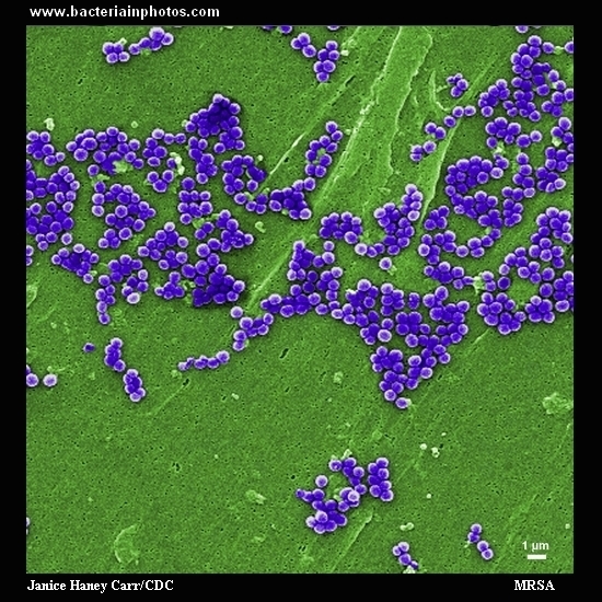 methicillin-resistant Staphylococcus aureus   
                         microscopy, gram-positive cocci